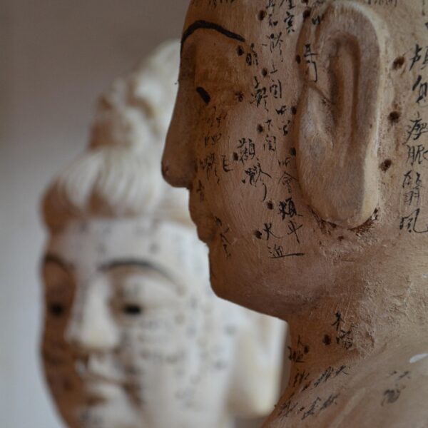 acupuncture-2956853_1280